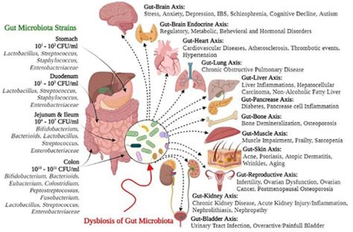 Unlock The Secrets Of Hasbulla Disease: Unveiling Genetic Insights